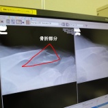 『フレーム修繕中』の画像