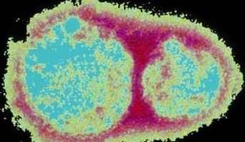 あらゆるがん細胞を殺してくれると期待のウイルスが開発される。来年にも人体での治験を開始