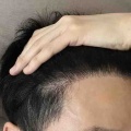 ９ヶ月経過