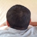 頭髪再生！ その２