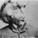 見世物小屋に自らを売り出し…実在したエレファントマン『ジョゼフ・メリック』の数奇な人生