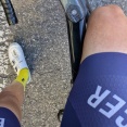 ライド後に謎の発疹？真夏のライド後に起きた、レーパン裾まわりの肌トラブル