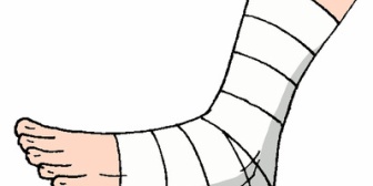 【愚痴】息子の幼稚園の歩いて通うグループの近所のママ友が、自宅の階段から落ち足首を捻挫したらしい…