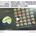 【速報】コロナ後遺症30人の脳を調べた結果→『とんでもない事実』が判明
