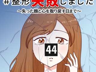 #整形失敗しました〜失った顔と心を取り戻すまで【44】