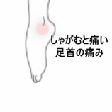 『サッカー中の足首捻挫による鈍痛と動作制限  登別室蘭すのさき鍼灸整骨院　症例報告』の画像