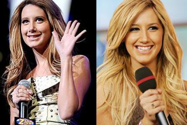 ハリウッドセレブゴシップ最新激痩せダイエット整形ゴシップ 整形 ゴシップ