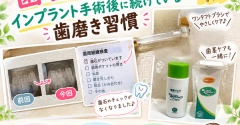 【歯医者の定期健診】歯石が減った！インプラント手術後に続けている歯磨き習慣