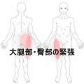 立位時に右脚外側と臀部に強い緊張を感じる腰痛 　登別室蘭すのさき鍼灸整骨院　症例報告