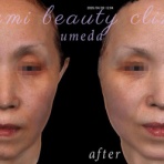 ～Dr.Fumiの美容Blog～