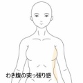 動作で悪化する左脇腹の突っ張りと痛み　登別室蘭すのさき鍼灸整骨院　症例報告