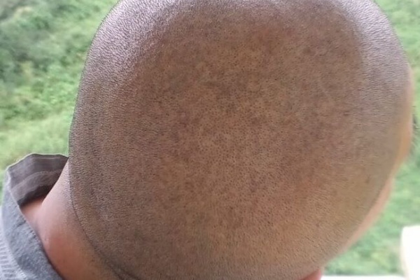 坊主男 スーパー坊主探偵団