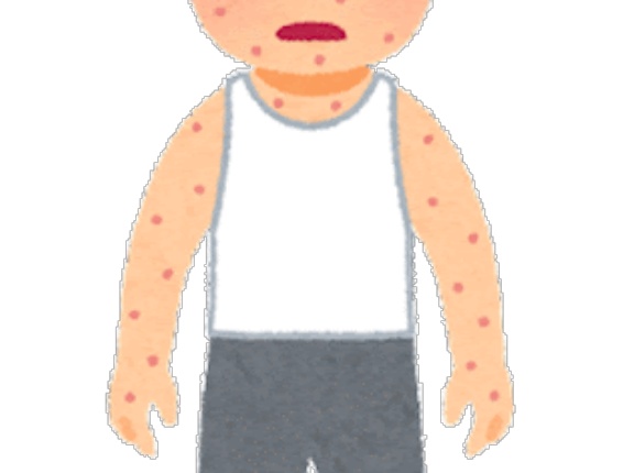 韓国人「韓国で性病が蔓延するようになったのもすべて日本が悪いんです」