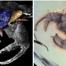 ミャンマー産の琥珀から、独特な形をした古代の昆虫が発見されました。