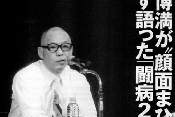 顔面神経麻痺 ヒデマオの徒然日記