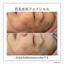 肌のホワイトニング！？