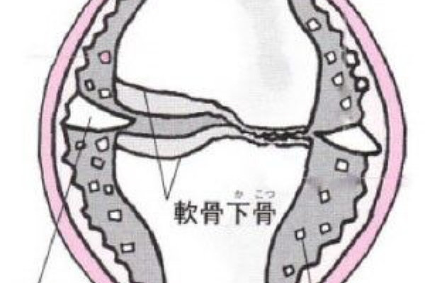 リピートが倍増する4つの盲点　DVD 治療院経営研究会PCC 花谷博幸 花谷博幸の成功する治療院経営 - 花谷ブログ「成功する治療院経営」