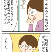 ホットフラッシュで顔にブツブツができた話②