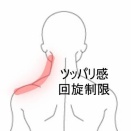 数週間続く左頸部の突っ張り感と回旋制限 　登別室蘭すのさき鍼灸整骨院　症例報告