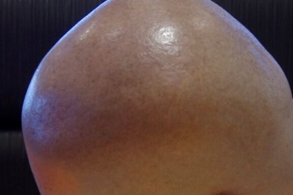 坊主男 スーパー坊主探偵団