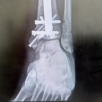 げんさんのすっきりスキー