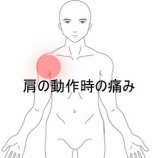 『ベンチプレス後に生じた右肩60度挙上時の痛み 登別室蘭すのさき鍼灸整骨院　症例報告』の画像