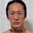 Before〜2Week
