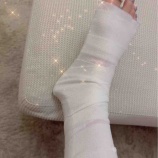 『骨折経過』の画像