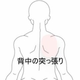 『右肩甲骨内縁の突っ張りと全身の重さ 　登別室蘭すのさき鍼灸整骨院　症例報告』の画像