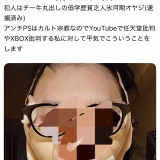 【朗報】アンチの襲撃で顔面重症を負った プレステ系美人YouTuberが完全復活！
