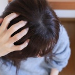 【大惨事】女性、ハゲ対策にミノキシジル使ったら顔面がこうなる