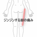 『長時間座ると出現する右脚外側のジンジン痛 登別室蘭すのさき鍼灸整骨院 症例報告 』の画像