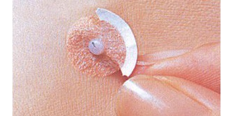 肩凝ってるわけでもないのに彼から針の付いたエレキバンを貼るように言われた。貼る部位にドン引き