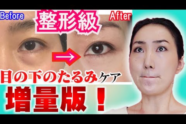 50代からの美人入門 目の下のたるみ