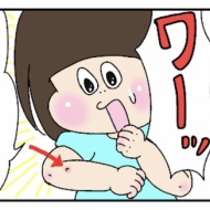 新しい皮ふ科のお話②