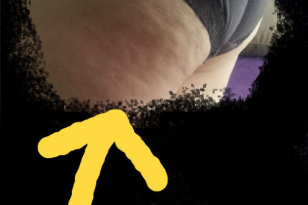 家庭用キャビテーション継続中 体験談ブログ効果と人気と口コミは 家庭用キャビテーション効果検証中