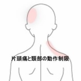 『ヨガ後の頸部痛と動作制限、片頭痛を伴う症状 　登別室蘭すのさき鍼灸整骨院　症例報告』の画像