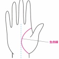 生命線がない人がいた