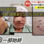 クマの爪がどれだけヤバイのかよく分かる構造が話題に　そりゃ通りで被害者がキズだらけになるわけだ…