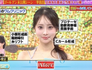 マツコ「整形女子が綺麗だと思えないの。美の基準が違いすぎて、街を歩いてる港区女子の顔が怖くて最近」