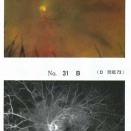 117D73 　　糖尿病性網膜症