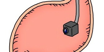 初めて胃カメラの健康診断をうけて、かなり辛くて衝撃を受けたんだ。