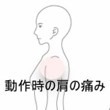 『バックステップ時の肩の痛みとスポーツパフォーマンス低下 　登別室蘭すのさき鍼灸整骨院　症例報告』の画像