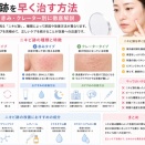 【最短で改善】ニキビ跡を早く治す方法｜赤み・色素沈着・クレーター別に徹底解説