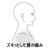 『動作時にズキッと痛む肩関節の痛み　登別室蘭すのさき鍼灸整骨院　症例報告』の画像