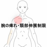 『仕事中の腕の痺れと頸の痛みが増強する頸椎ヘルニア 登別室蘭すのさき鍼灸整骨院　症例報告』の画像