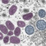 【悲報】アメリカ、あっという間にサル痘感染者1万人を突破