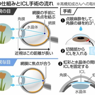 さよなら、ジョン・レノン携帯 : ZAKKAN