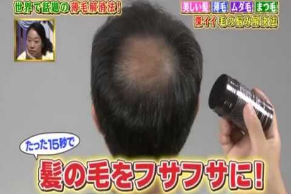 薄毛の徹底対策 抜け毛が最近気になる それにはこれだ
