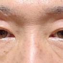 49日目